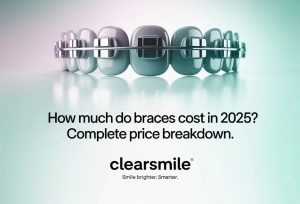 How Much Do Braces Cost in 2025? Complete Price Breakdown